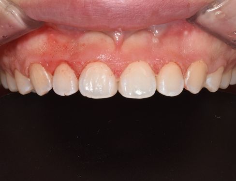 제목 없는 디자인 (1)