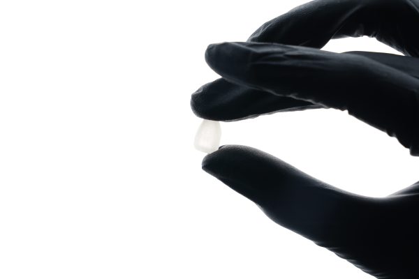 Dental,Smile,Design,White,Teeth,Ceramic,Veneer,Close-up,Super,Thin